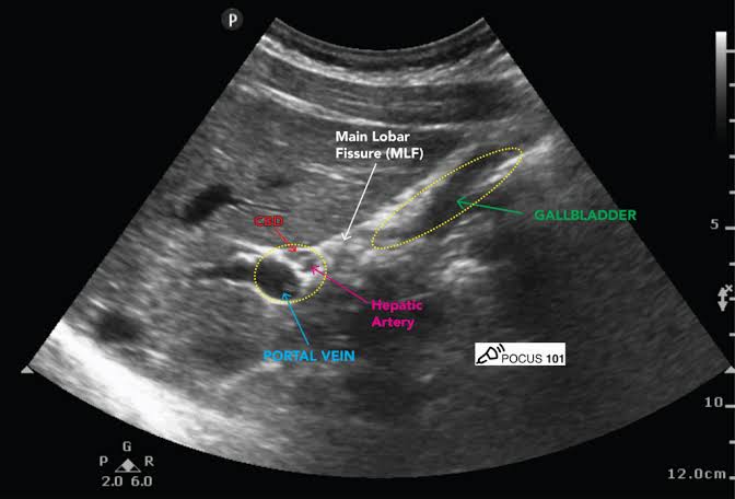 Abdominal ultrasound