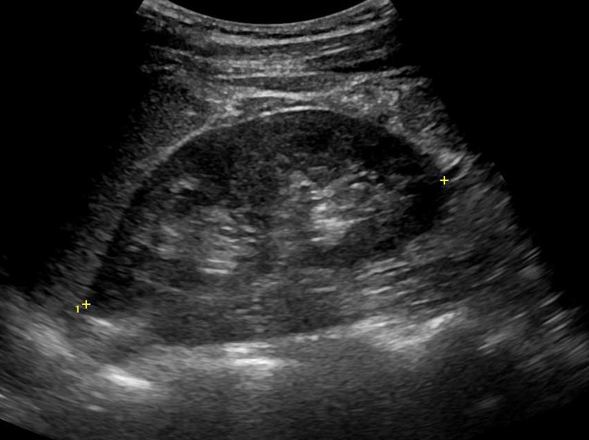 Urological ultrasound