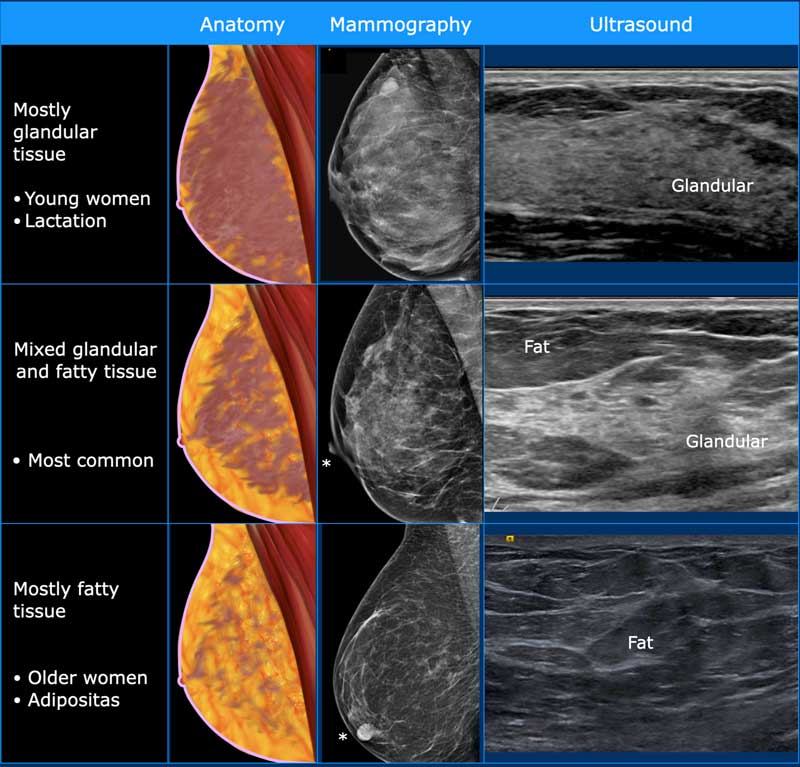 Breast ultrasound