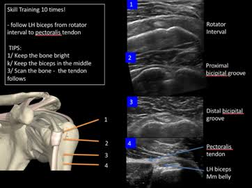 Musculoskeletal ultrasound