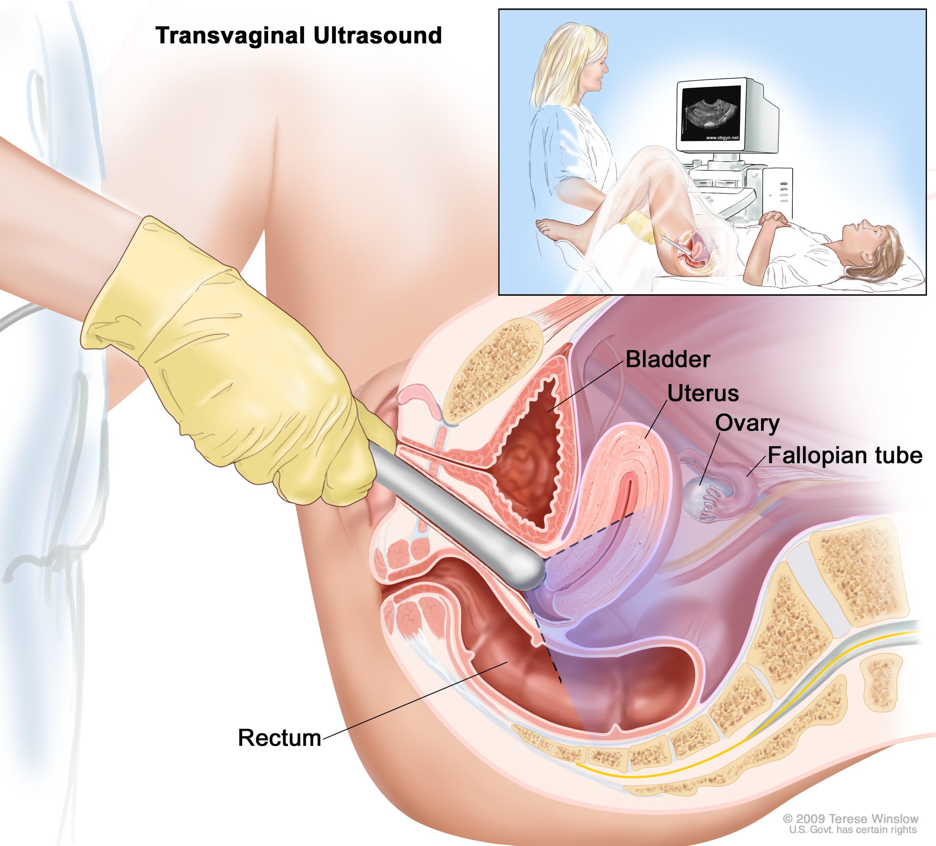 Ultrasound services