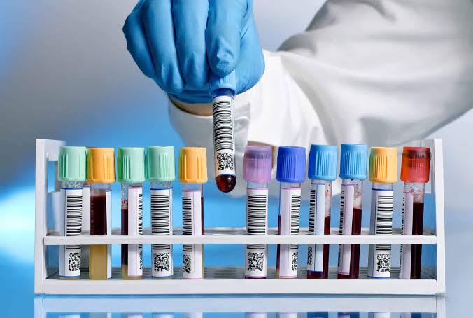 Laboratory diagnostic testing