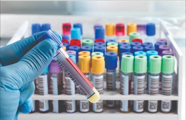 Laboratory testing at Victory Laboratory & Ultrasound Services