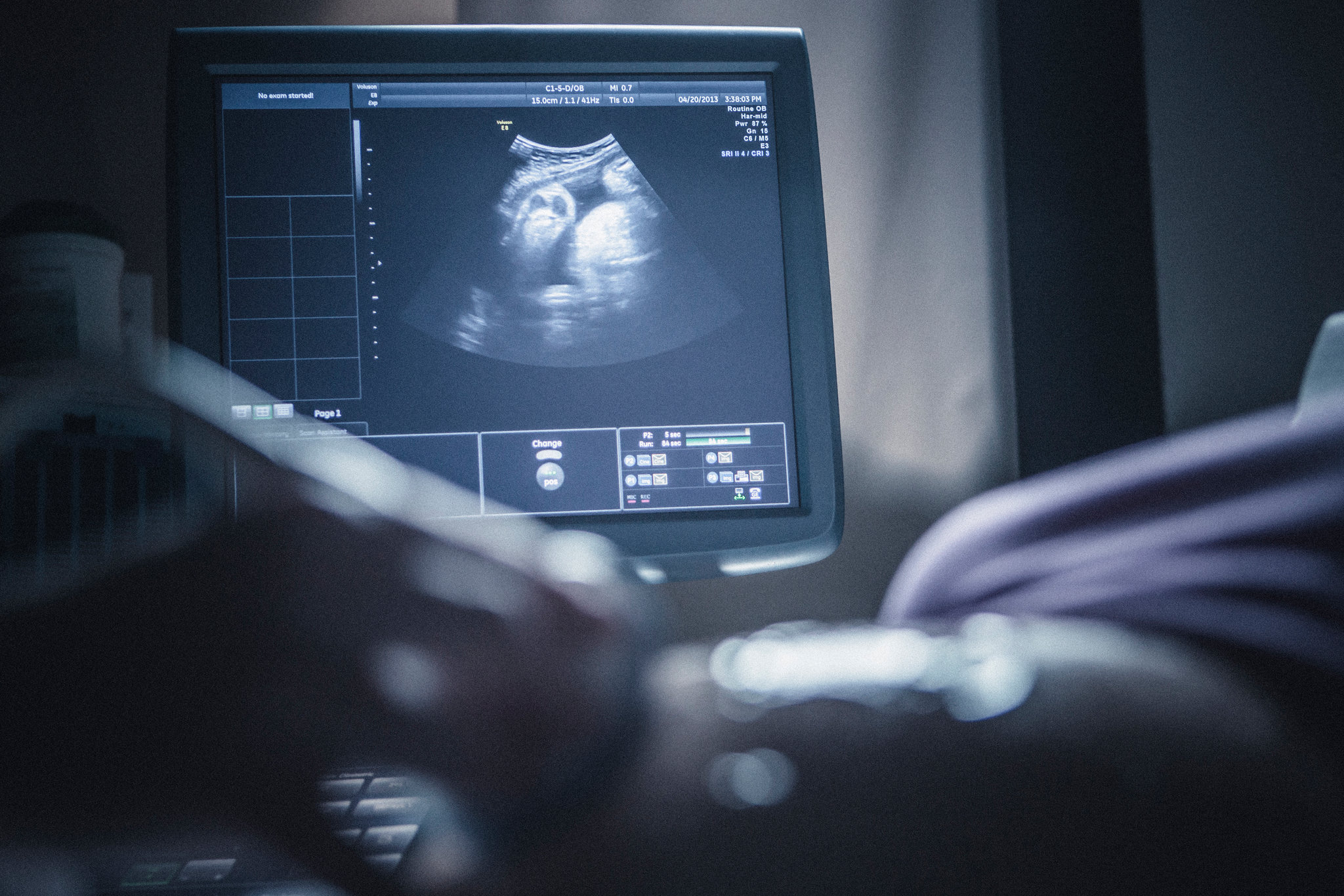Ultrasound examination at Victory Laboratory and Ultrasound Services