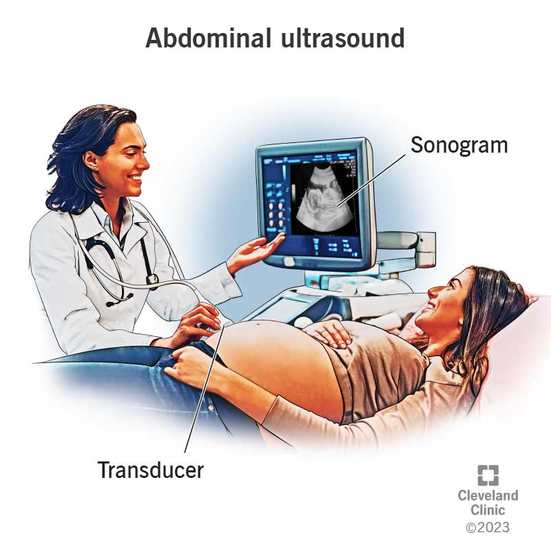 Ultrasound diagnostic examination